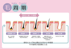 光脱毛の間隔を守る美肌ケア | Riliy eyelash 沖縄県那覇市 |Riliy eyelash